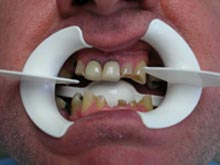 Tandbehandling i udlandet
